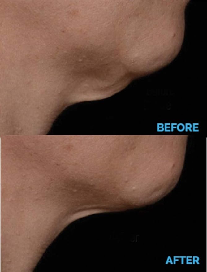 N.E.C.K Control: Neck Lifting, Firming And Retracting Cream