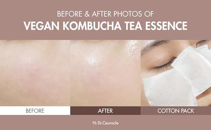 Dr.Ceuracle Vegan Kombucha Cream Essence Toner - Korean Skincare Hydrating Milky Toner with Kombucha Tea Extract, Centella Asiatica, Ceramide (150 ml / 5.07 fl. oz.)