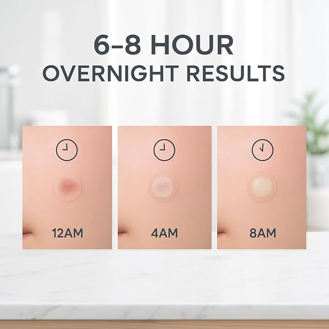 LE GUSHE Korean Pimple Patches for Face (78 Dots) - Hydrocolloid Acne Patches with Tea Tree Oil - Invisible Zit Stickers - Dermatologist Tested - Korean Skin Care