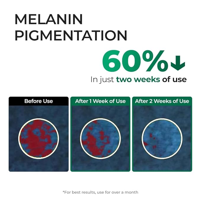 EASYDEW DW-EGF Melatoning One-Day Ampoule - Dark Spot Correcting Korean Facial Serum for Uneven Skin Tone & Dull Skin with EGF, Glutathione, Niacinamide - Age Defying Skincare, 0.03fl oz x 7ea