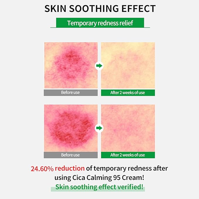 wellage Cica Calming Cream - Korean Face Soothing Moisturizer, High Purity Madecassoside with Centella Asiatica Panthenol - Calms Sensitive Skin, Anti-Redness & Rosacea, Anti-Scaling & Blemish, 2.7oz