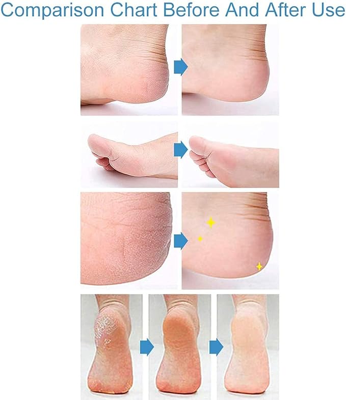 Panasonic ER240B Beard & Mustache Trimmer for Men