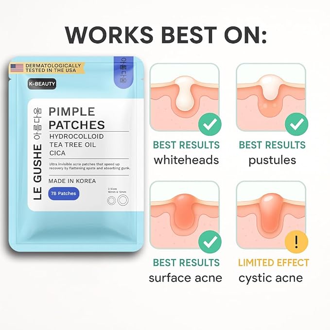 LE GUSHE Korean Pimple Patches for Face (78 Dots) - Hydrocolloid Acne Patches with Tea Tree Oil - Invisible Zit Stickers - Dermatologist Tested - Korean Skin Care