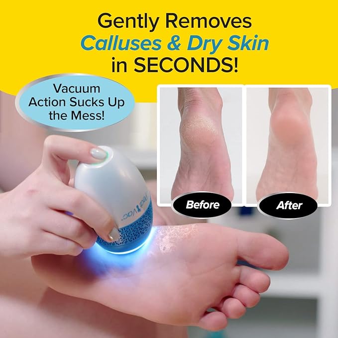 As Seen On TV Electric Callus Remover + Built-In Vacuum Sucks Up Shavings,Gently Removes Calluses & Dry Skin in Seconds, Mess-Free, Spins at 2000 RPMs, LED Light, 2 Speed Settings, 3.5"x 2.5"