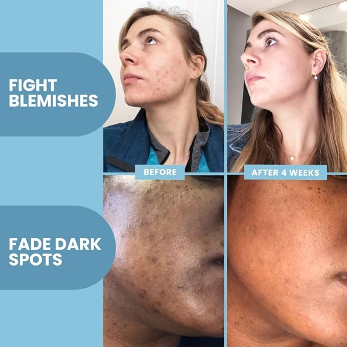 Eva Naturals Vitamin C Face Serum With Hyaluronic Acid - Anti Aging Serum - Reduce Dark Spots, Acne & Wrinkles - Retinol, Niacinamide & Salicylic Acid, Brightening Skin Serum for Glowing Skin