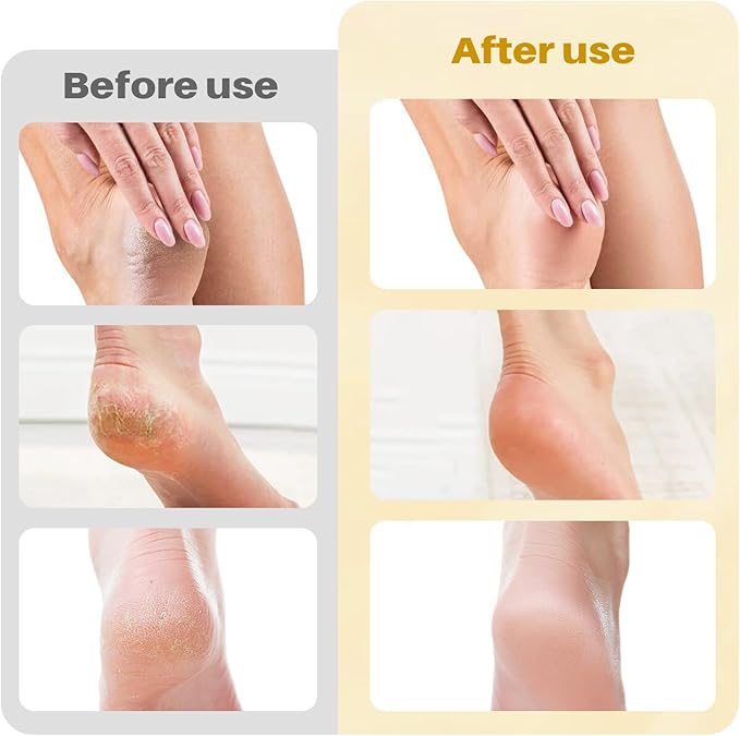 Electric Foot File and Callus Remover,Professional Pedicure Tools for Dry, Calluses, Dead, Cracked, Hard Skin,Equipped with 60 Pcs Sandpaper Discs