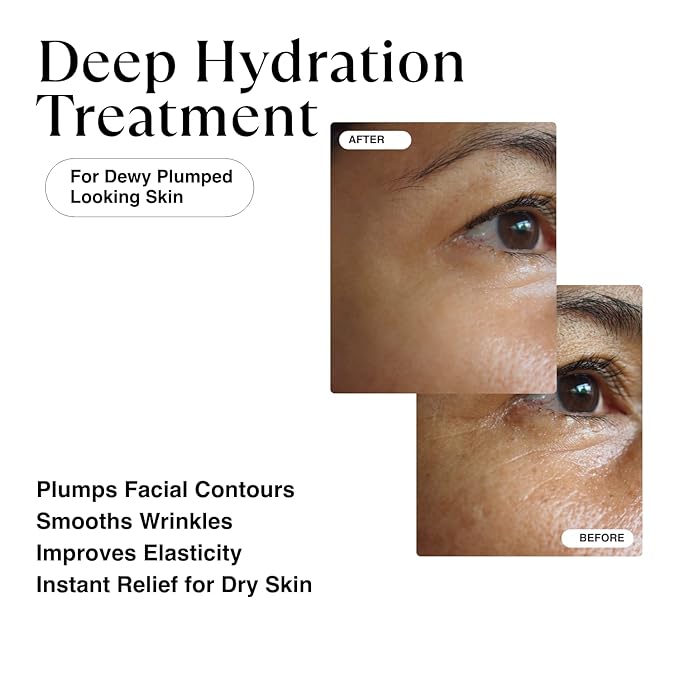 MATKAS Korean Hyaluronic Acid Serum for Face 1 Fl. Oz. with Niacinamide B3 + Vitamin B5 + 8 Peptides and Ginseng Root Extract for Deep Firming, Plump Wrinkles, Hydrating Serum, Anti Aging Facial Serum