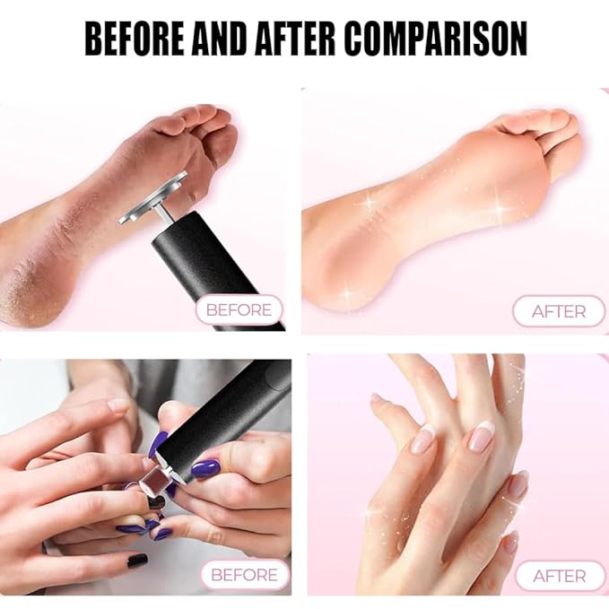 Cordless Electric Callus Remover for Feet with Nail File Sander 2 in 1 Rechargeable Foot File Grinder for Dead Skin Crack Dry Calluses with Sandpaper Disk 6 Speed Adjustable