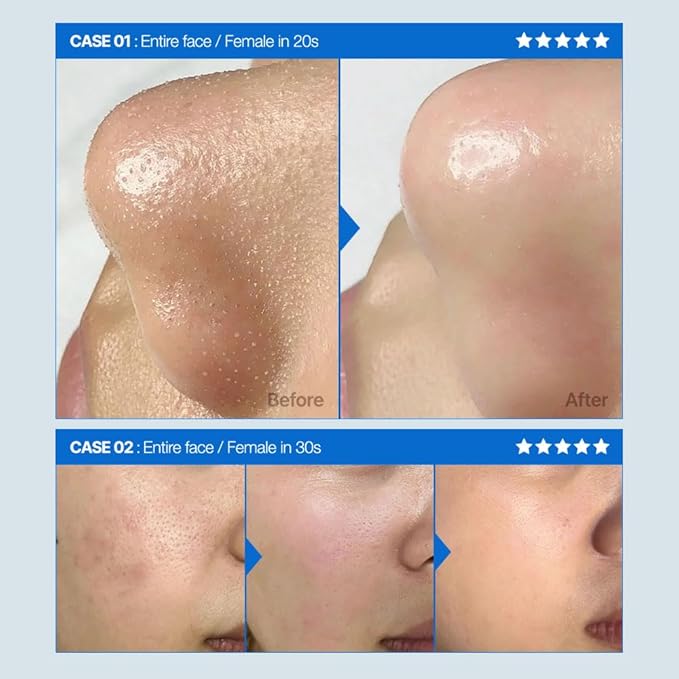 Skin-FIT Water, Pore-Refining & Tightening, Gentle Pore Care, Balancing & Hydrating, Oil-Controlling, 8.96fl.oz/265ml