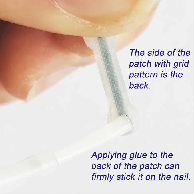 Titanium Alloy Silicone Ingrown Correction Tool Kit,Ingrown Toenail Treatment,Ingrown Toenail Removal Kit,Designed for Ingrown Nail Repair, nail Corrector, Cuttable Applicable to most sizes,reusable