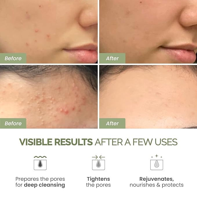 PLANTIFIQUE Korean Skincare Clay Mask – Hydrating Mud Mask with Avocado & Superfoods, Dermatologist-Tested for Face & Body – Vegan, 3.4 Oz/100ml