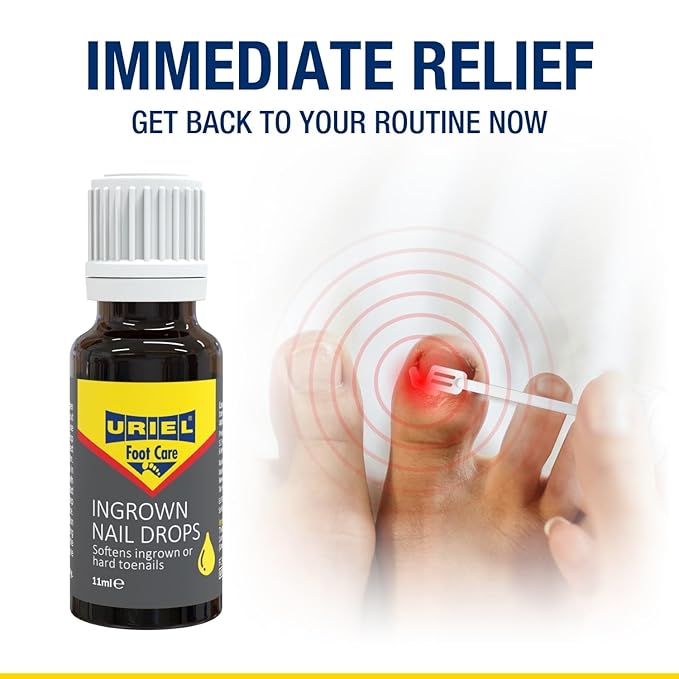 URIEL UPGRADED Ingrown Toenail Treatment, Ingrown Toenail Removal Kit, Ingrown Toenail Corrector, Ingrown Nail Kit Ingrown Toenail Tool 11 ml