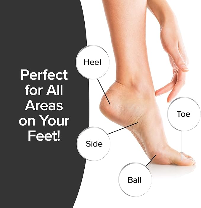 As Seen On TV Electric Callus Remover + Built-In Vacuum Sucks Up Shavings,Gently Removes Calluses & Dry Skin in Seconds, Mess-Free, Spins at 2000 RPMs, LED Light, 2 Speed Settings, 3.5"x 2.5"