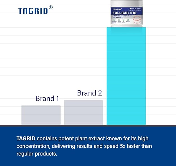 TAGRID Folliculitis Treatment Cream, Ingrown Hair Treatment, Soothing Scalp, Face & Body Cream - Hydrating & Refreshing - 100g