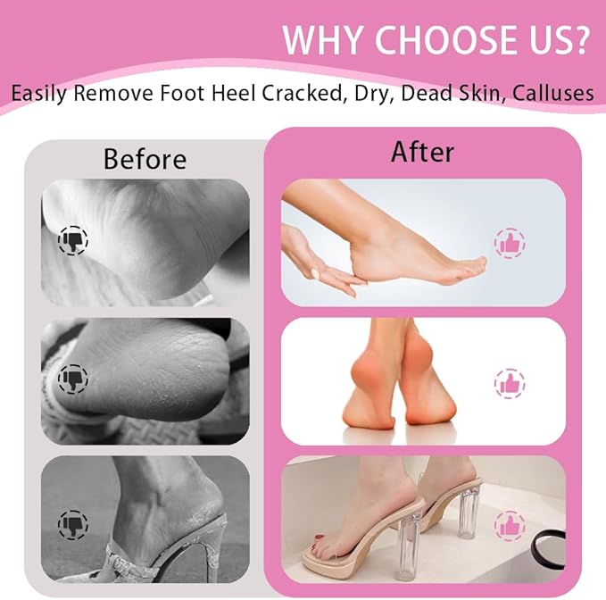 Electric Foot Callus Remover,MOWLIE Electric Foot Care Tools with Speed Controller and 60pcs Replacement Sandpaper Disk for Men Women Dead Dry Crack Skin Calluses (Pink)-5