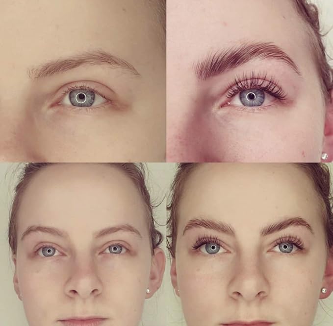 Eyelash Growth Serum - Instant Lash serum for eyelash growth with Hyaluronic Acid - 100% Natural Dermatologist Tested and Approved Eyelash Enhancer - Eyebrow serum to grow brows thicker - (5ml)