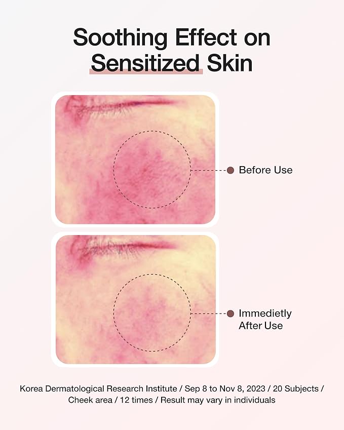 CENTELLIAN 24 Expert Cream (Signature, 1.69fl oz) - Premium Age-Defying Moisturizer for Wrinkles, Aging, Sensitive Skin. Korean Skin Care. Centella Asiatica, TECA, Gotu Kola