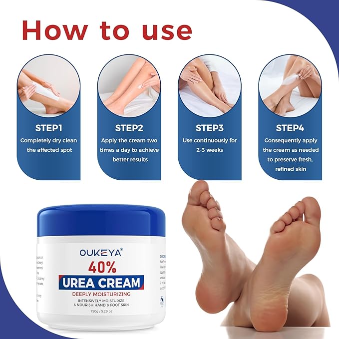 NEW FORMULA Urea Cream 40 Percent for Feet Maximum Strength, Hand Heels Dry Cracked Treatment Lotion for Knees & Elbows, Foot Dead Skin Cuticle Callus Remover Toenail Softener, 5.29 oz