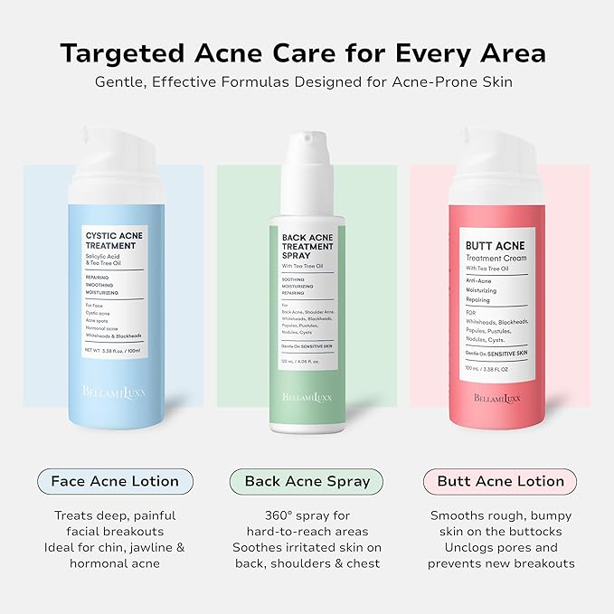 Fungal Acne Treatment Lotion: Effective Face & Body Pimple Cream for Bumps, Clusters, Itch & Redness – Fungal Prone Skin Acne Treatment Moisturizer for Teens & Adults with Natural Actives
