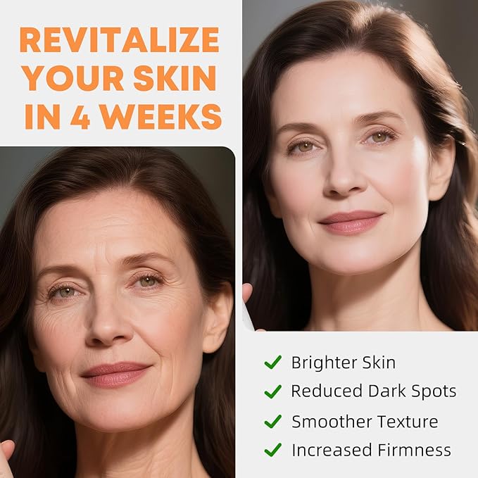 Vitamin C Serum for Face with Hyaluronic Acid & Vitamin E - Brightening Anti-Aging Serum & Dark Spot Corrector for Sensitive Skin, Hydrates Firms Lifts and Smooths Wrinkles & Age Spots