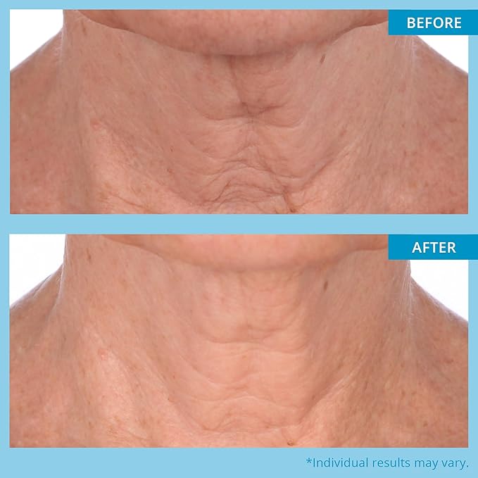 SKINN Neck Cream for Wrinkles, Neck Amour Leave-On Mask - Neck Firming Cream, Tightening & Lifting Sagging Skin - Chin & Neck Firming Lotion for Smoother & Firmer Skin - Neck Cream for Men & Women