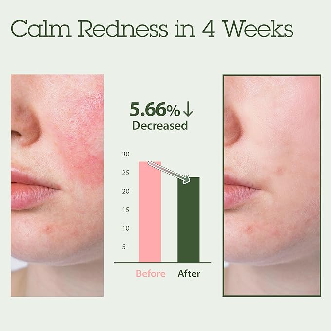 Blithe Korean Skin Care Products 6 Leaves Clear Essence for Rosacea & Redness Relief, BHA Toner Cooling Moisturizer for Face, Blackhead Treatment, Evening Primrose Wintergreen Green Tea 1.83 Oz