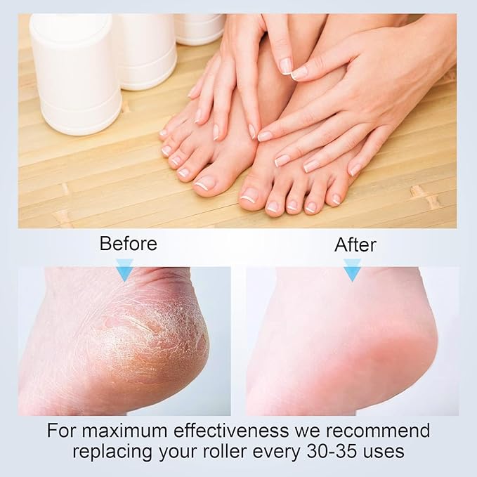 6 Pack Replacement Roller Refill Heads for Electric Callus Remover for Feet,Pedicure Kit Refill Rollers Extra 4 Regular Coarse & 2 Fine Coarse Electronic Foot File