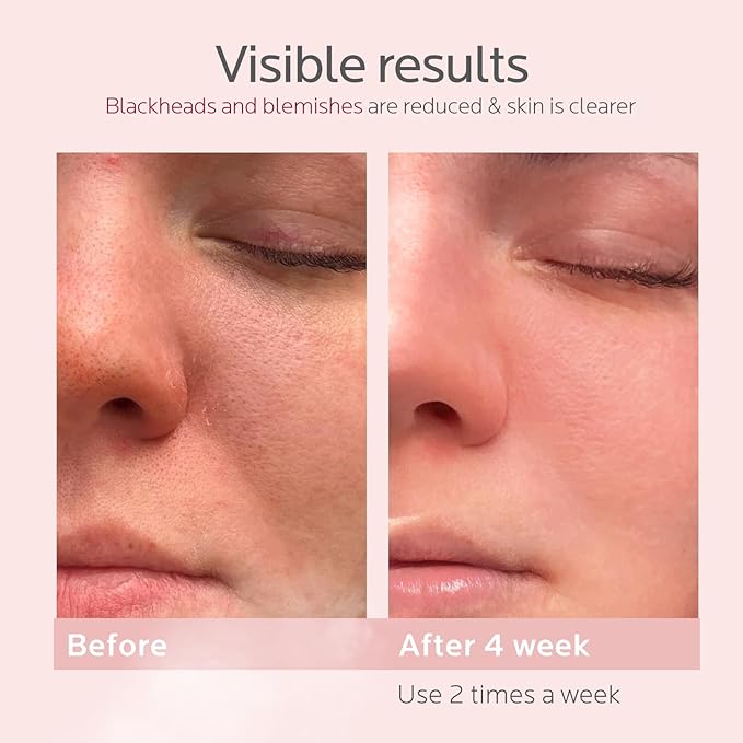 Colorfarm Facial Steamer Skin Care Kit: Face Steamer Home Spa Deep Cleaning Unclogs Pores with 4 Skin Care Tools - Relaxing Self Care Skincare Beauty Gifts for Women (On-The-Go Beauty Quick Fix Kit)