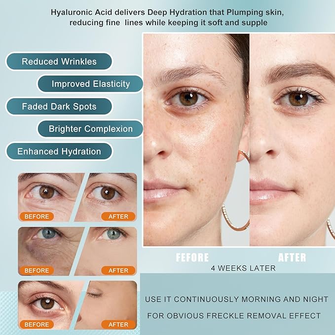 Vitamin C Serum for face with Hyaluronic Acid & Peptides - Anti Aging Face Serum for Women & Men, Dark Spot Corrector for Brightening, Hydrating Treatment to Reduce Wrinkles & Fine Lines, (Pack of 2)