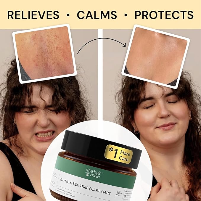 Thyme & Tea Tree Flare Care | Solution for Painful Pimples, Cystic Acne, Ingrowns, Folliculitis, Groin Flare Ups, Razor Bumps | Bartholin | Safe Flare-Up Solution with Egg Yolk Extract & Tea Tree 1 oz