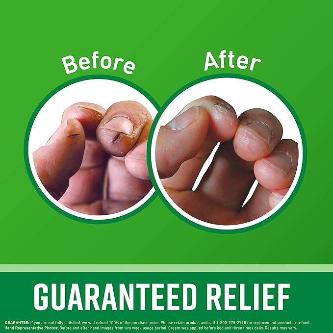 O'Keeffe's Working Hands Hand Cream, 6.8 oz Jar and Healthy Feet Foot Cream, 6.4 oz Jar - Repairing Skincare for Extremely Dry, Cracked Hands and Feet