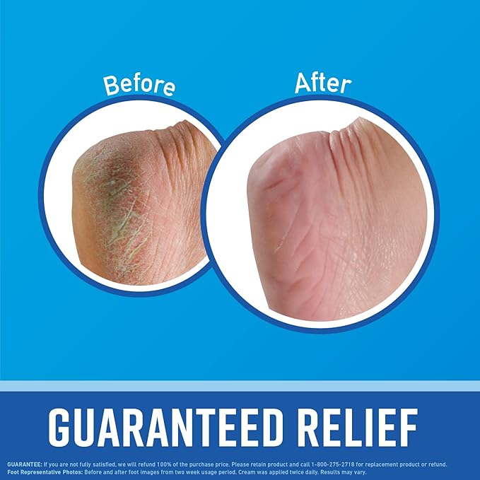 O'Keeffe's for Healthy Feet Foot Cream - 7 oz Tube (1 Pack) - Guaranteed Relief for Extremely Cracked, Dry Feet, Repairing Skincare, Instantly Boosts and Retains Moisture Levels
