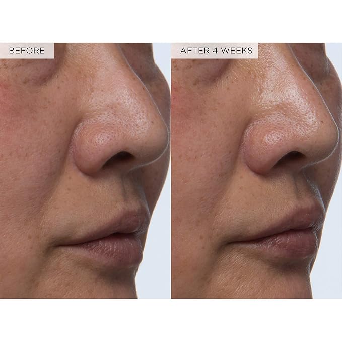 Glow Recipe PHA + BHA Face Toner - Korean Skin Care Pore Minimizer & Gentle Facial Exfoliator for Tightening, Hydrating & Exfoliating - Glycerin, Watermelon & Cactus Water (150ml)