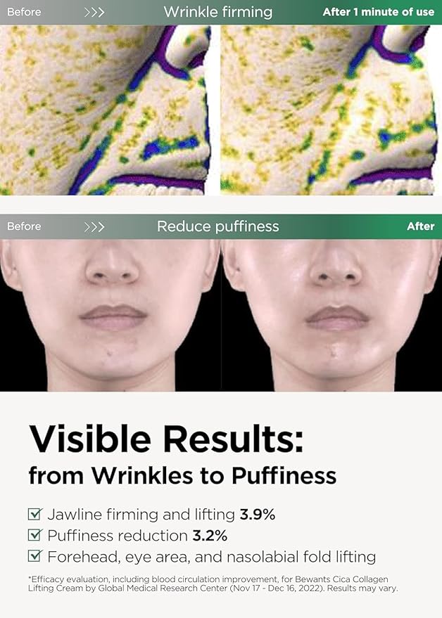 Bewants Guasha Neck Cream, Lifting & Firming Moisturizer with Centella Asiatica & Vegan Hyaluronic Acid – Includes RABIE Rabbit Edition with Smartphone Grip