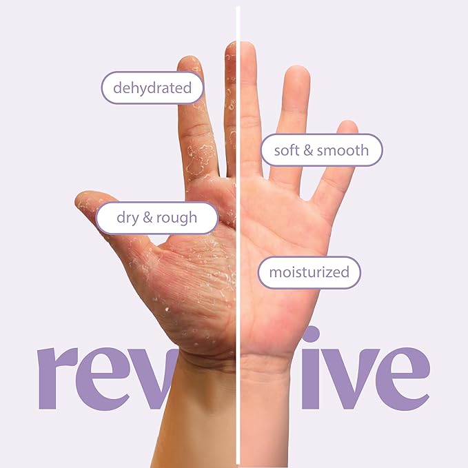 12 Pairs Original Derma Beauty Hand Mask Bulk Moisturizing Hand Gloves for Dry Hands Nail Care Essential (Shea Butter + Avocado)