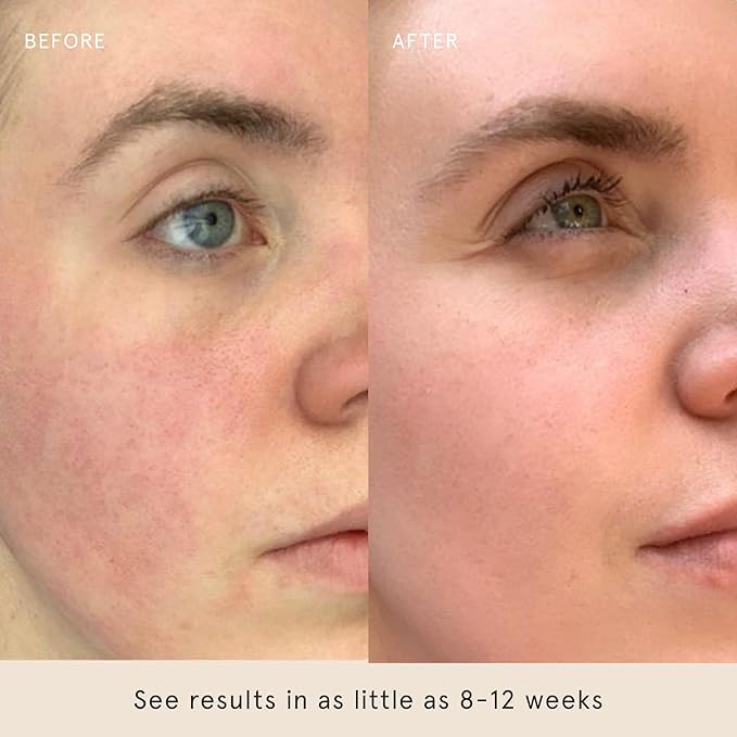 Barefaced Sheer Protection SPF 50+ – Broad-Spectrum Face Sunscreen with Zinc Oxide, Niacinamide & Hyaluronic Acid – Oil-Free UV Protection, Hydration & Anti-Aging with Universal Tint (60ml)