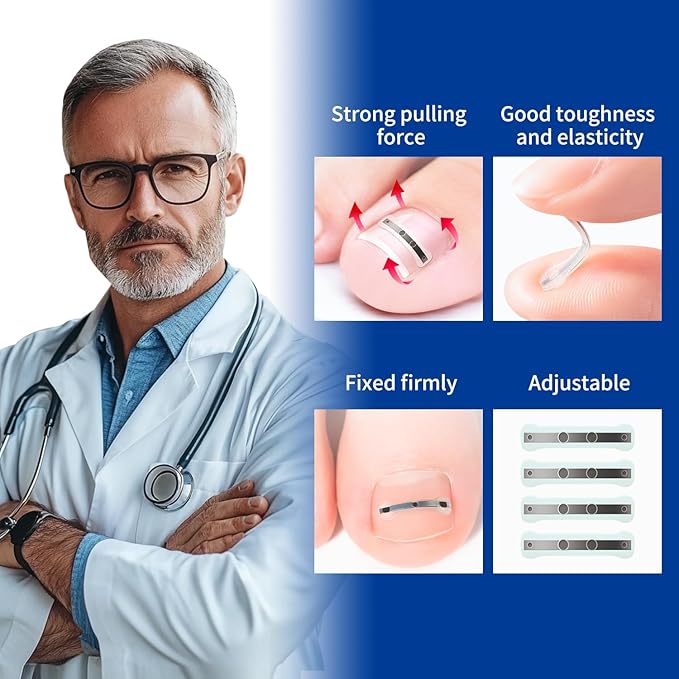 Ingrown Toenail Treatment, 10 packs Titanium Alloy Ingrown Toenail Corrector for all size foot, Ingrown Toenail Removal Kit for Curved Nail Repair, at Home Nail Kit Tools-Blue3