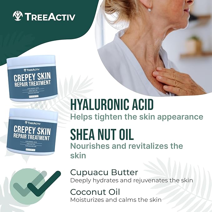 TreeActiv Crepey Skin Repair Treatment Original Formula, 8 fl oz, Firming Cream For Face & Neck, Skin Firming Lotion with Hyaluronic Acid, Crepey Treatment to Address Dry Crepe