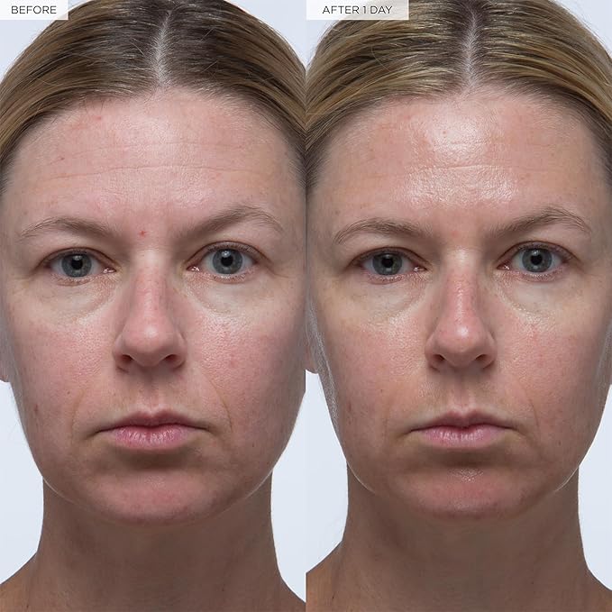 Glow Recipe Plum Plumping & Hydrating Hyaluronic Acid Korean Skin Care Serum - Antioxidant Anti Aging Face Serum + Vitamin B5 for Lasting Skin Barrier Repair & Firming Lines & Wrinkles - Vegan, 30ml