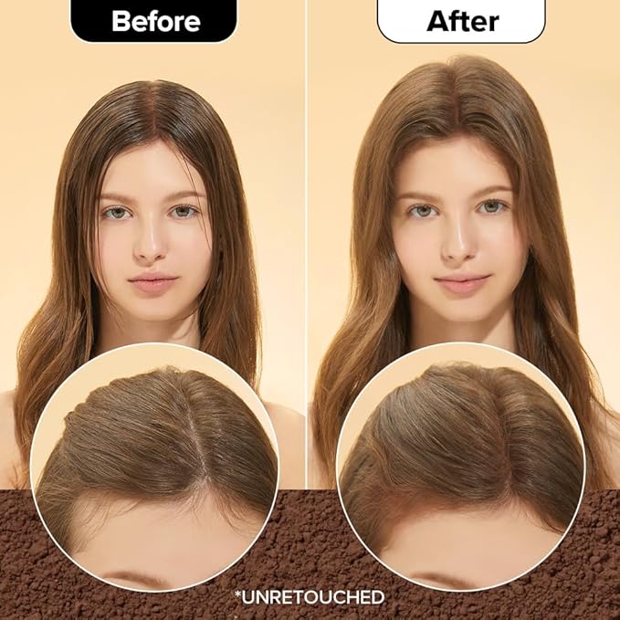 I DEW CARE Biotin Clarifying Dry Shampoo - Tap Secret Brown | Strengthening & Volumizing, Powder Type, Refillable, Travel size, Non-aerosol, Brunette, Korean Ginseng, Mother's Day, 0.24 Oz