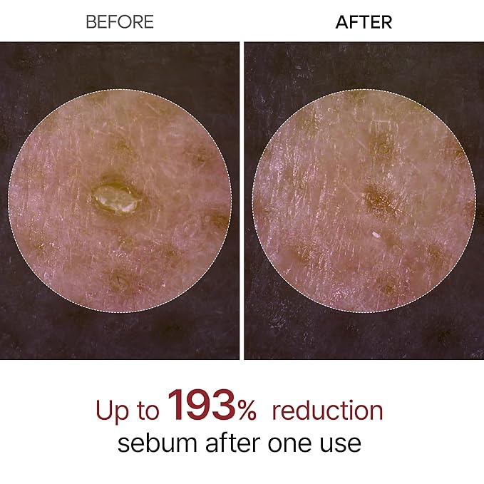 Peel Shot Glow White Rice Peeling Ampoule, Soft Exfoliating Face and Body Scrub Dead Skin Cells Remover for All Skin Types korean skin care 80ml