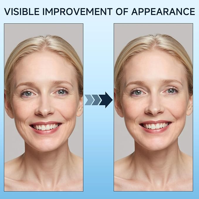 Under Eye Bags and Wrinkles, Under Eye Cream, Wrinkle Filler, Visibly Improves for Bags Dark Circles Treatment for Puffines, 15ml/0.5 fl.oz
