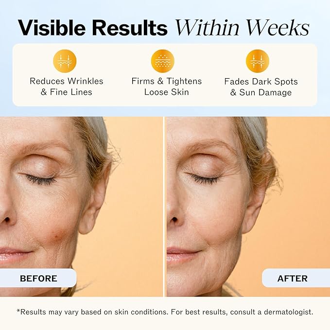 LilyAna Naturals Anti Aging Retinol Face Cream for Women – Wrinkle & Neck Cream for Firming, Retinol Moisturizer for Face with Hyaluronic Acid, Hydrating Night Cream for Fine Lines, Collagen Boost