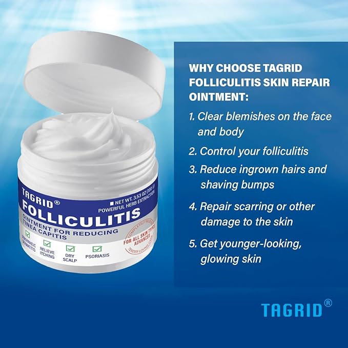 TAGRID Folliculitis Treatment Cream, Ingrown Hair Treatment, Soothing Scalp, Face & Body Cream - Hydrating & Refreshing - 100g