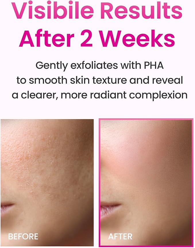 YADAH Collagen Hydra Essence – Deep Hydration, Soothing with 80,000ppm Collagen peptides and Triple Hyaluronic Acid, Centella Asiatica Extract, Niacinamide – 5.07 fl oz