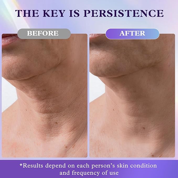 Retinol Neck & Face Wrinkle Cream for Women, Neck Cream for Tightening and Firming, Anti Aging Skin Care with Collagen & Hyaluronic Acid, Instant Face Lift Cream 2-Pack