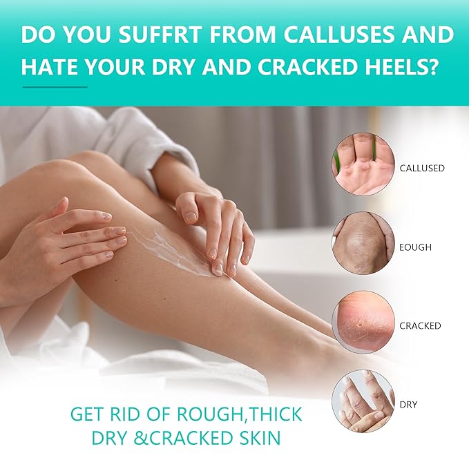 Urea Cream 40 Percent for Feet Maximum Strength, Urea Foot and Hand Cream with Powerful Hydration for Dry Skin, Cracked Heels, Deeply Moisturizing for All Skin Types 7.05oz