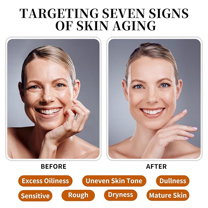 Snail Mucin Serum for Face with Collagen & Hyaluronic Acid,Smoothes Wrinkles,Improves Elasticity,Firms Skin 1 Oz Daily Use