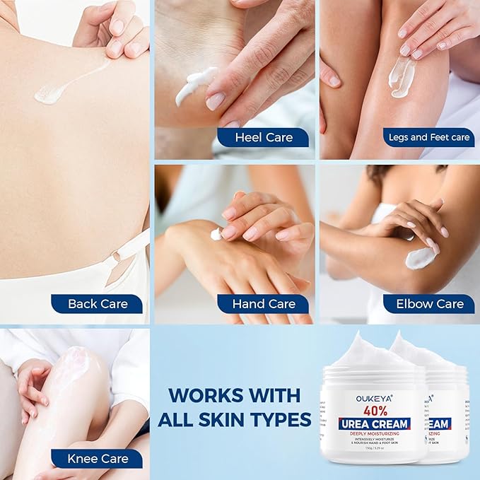 Urea Cream,NEW FORMULA Urea Cream 40 percent for Feet Maximum Strength,Dry Cracked Treatment Lotion for Knees & Elbows,Foot Dead Skin Cuticle Callus Remover Toenail Softener,5.29 oz 2 Packs