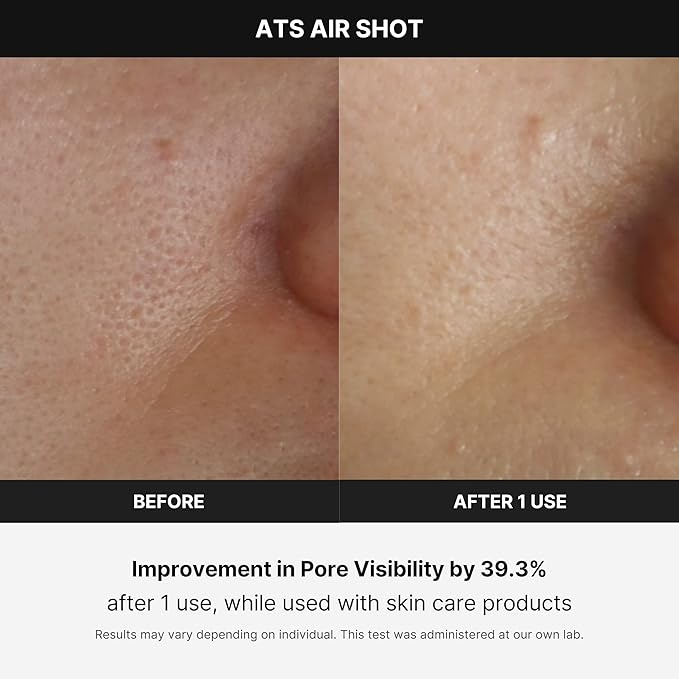 Medicube Age-R ATS Air Shot - Microneedling Skin Care Device for Pore Tightening, Enhanced Absorption, and Smoother Skin Texture - Exfoliation and Skin Rejuvenation - Korean Skincare